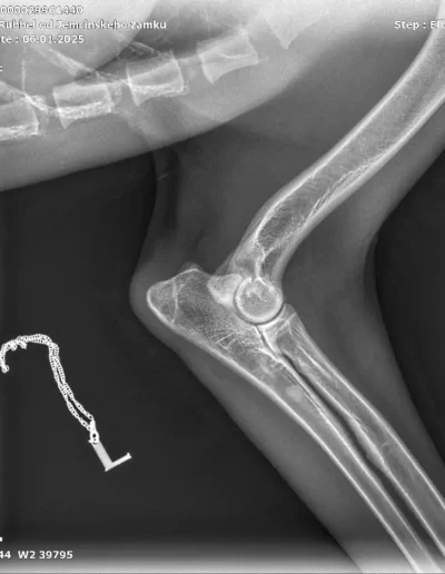 Rubble X-rays