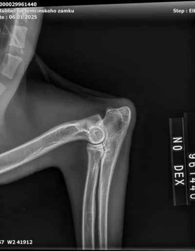 Rubble X-rays